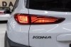 Hyundai Kona  2017.  5